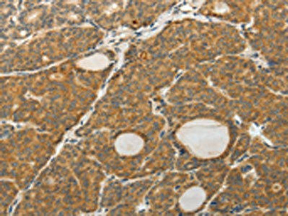 PGBD5 Antibody (PACO18489)