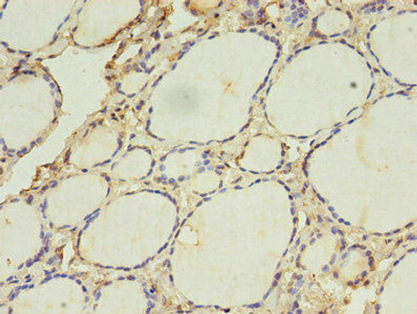 ACAA1 Antibody (PACO24700)