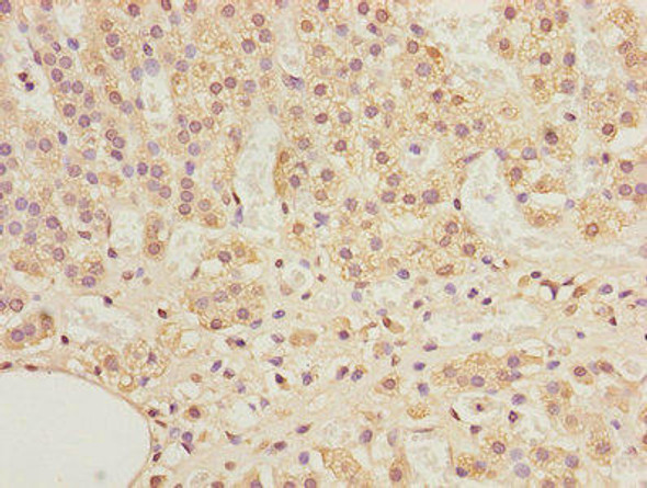 ADAMDEC1 Antibody (PACO24759)