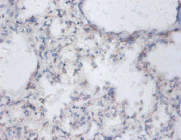 SAT1 Antibody (PACO31552)