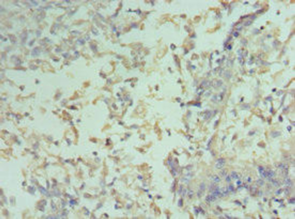 CCND2 Antibody (PACO43132)