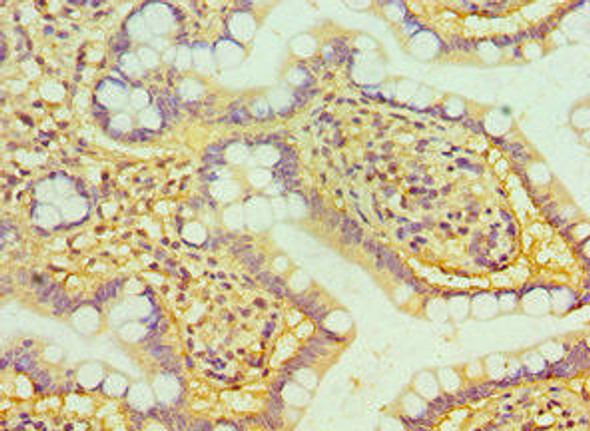 HTATIP2 Antibody (PACO43198)