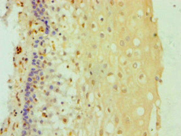 DDX3X Antibody (PACO43454)