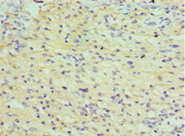 TDGF1 Antibody (PACO43622)