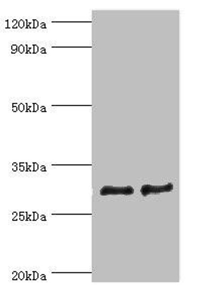 ATP5F1 Antibody (PACO43680)