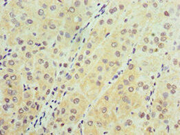 AARS2 Antibody (PACO43859)