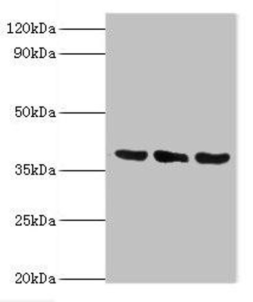 TMOD3 Antibody (PACO43887)