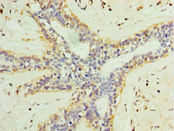 L3MBTL1 Antibody (PACO43916)