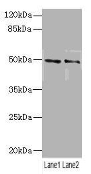 HTR3B Antibody (PACO45445)