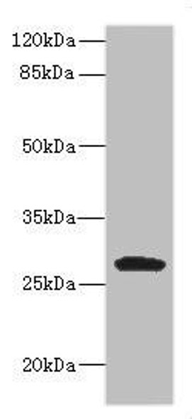 CLEC9A Antibody (PACO46642)