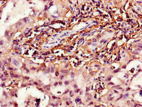 HPGD Antibody (PACO48962)