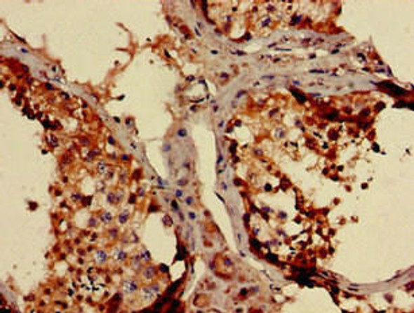 NDUFB3 Antibody (PACO49798)