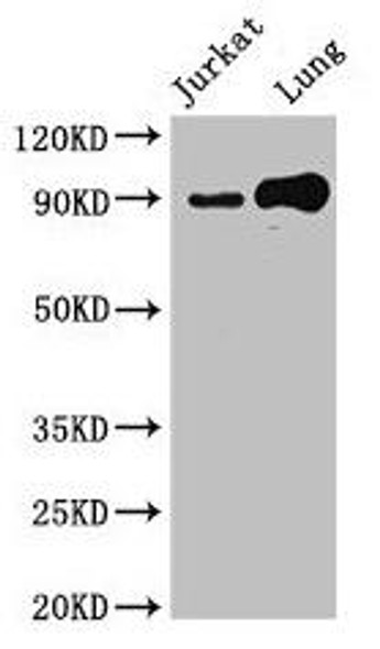 STAT5B Antibody (PACO50042)