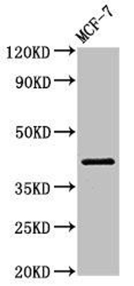 ACTR1A Antibody (PACO51302)