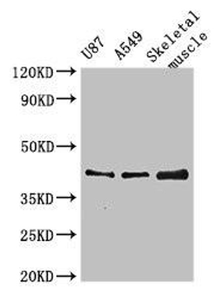 B3GALT4 Antibody (PACO51346)