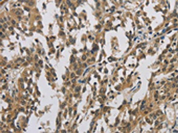 CASP3 Antibody (PACO13858)