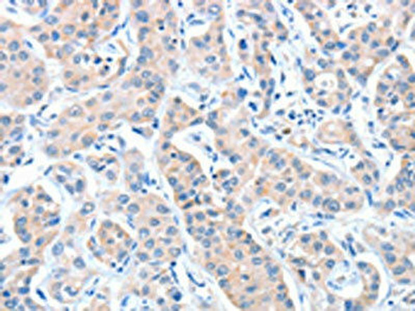 CASP7 Antibody (PACO13864)