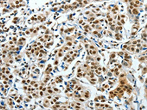 CREB1 Antibody (PACO13881)