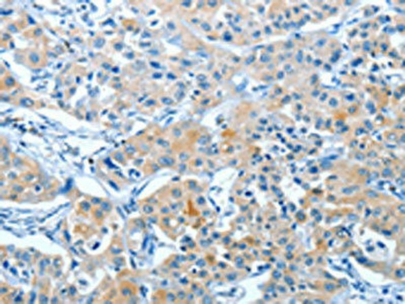 BAG3 Antibody (PACO13949)