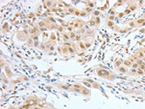 ATF2 Antibody (PACO14116)