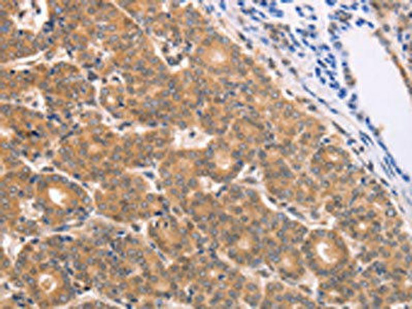 BTG3 Antibody (PACO14145)