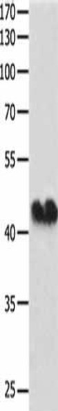 GJA1 Antibody (PACO14302)