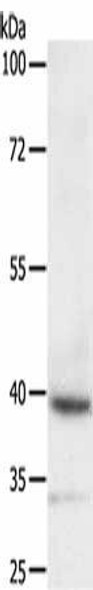 DTX3 Antibody (PACO14337)