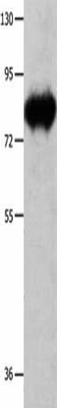 ECE1 Antibody (PACO14361)