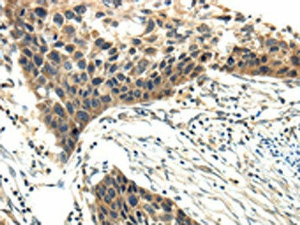 EFNA3 Antibody (PACO14382)