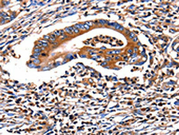 HP Antibody (PACO14527)