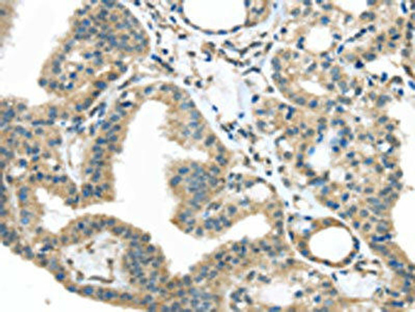 IGFBP4 Antibody (PACO14555)