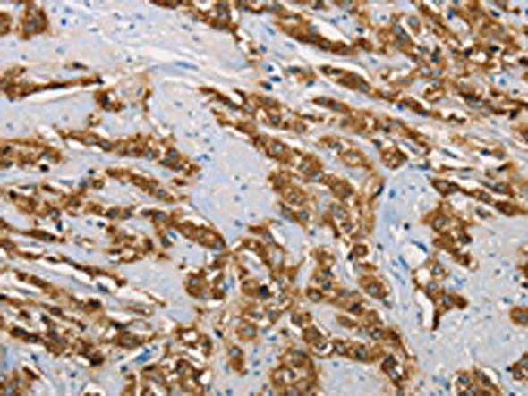 KLK1 Antibody (PACO14626)