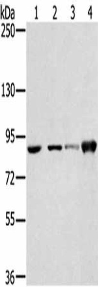 RNF214 Antibody (PACO17006)