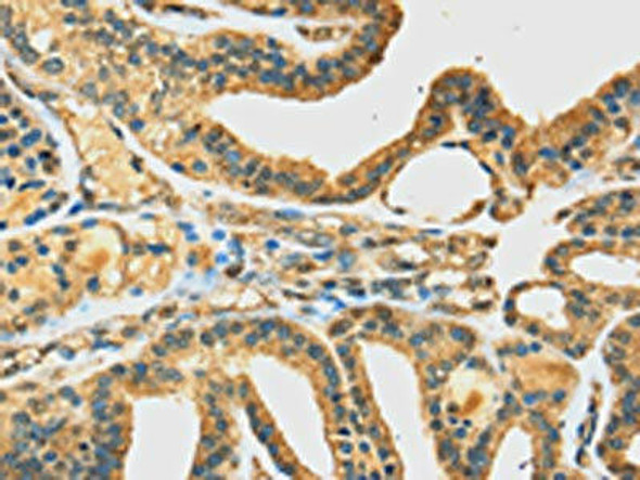 DHCR24 Antibody (PACO17058)