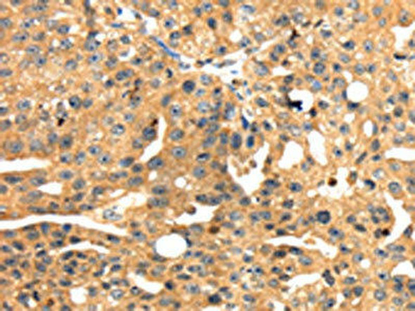 SH3KBP1 Antibody (PACO17088)