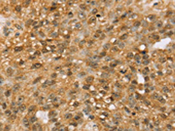 MED22 Antibody (PACO17179)