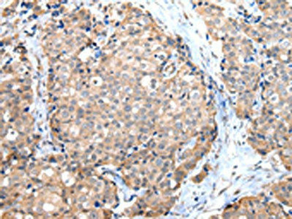 DUSP11 Antibody (PACO17395)