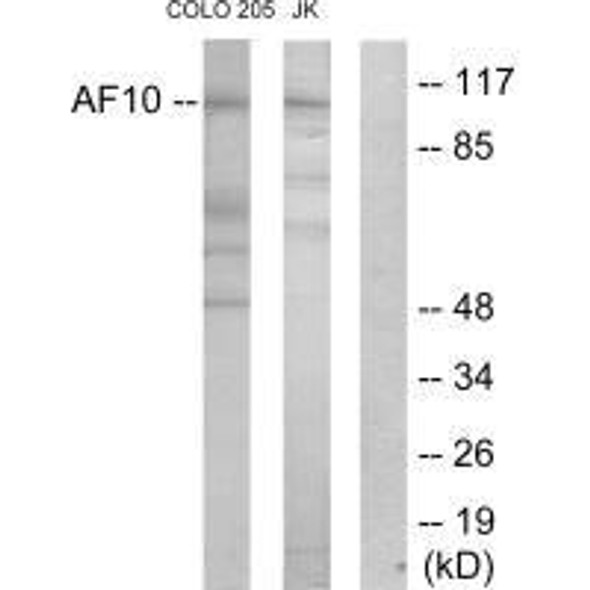 MLLT10 Antibody (PACO21809)