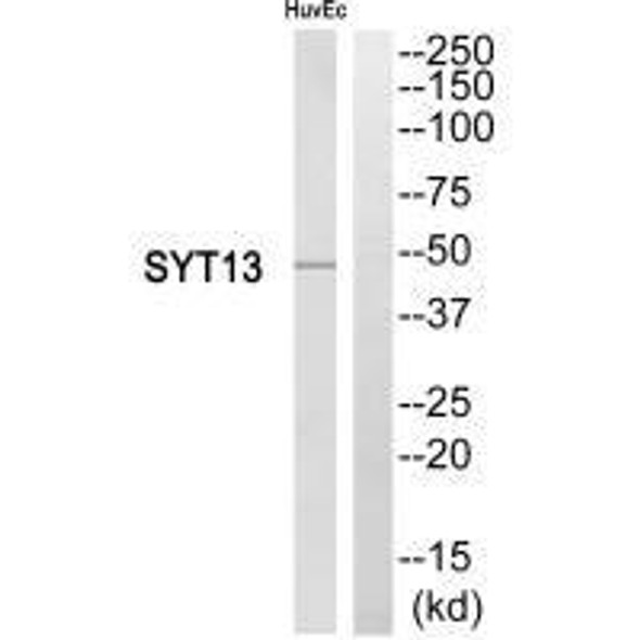 SYT13 Antibody (PACO22640)