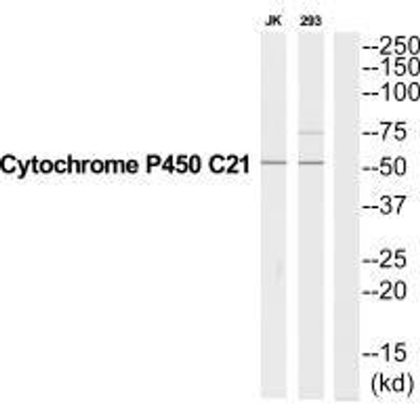 CYP21A2 Antibody (PACO22783)