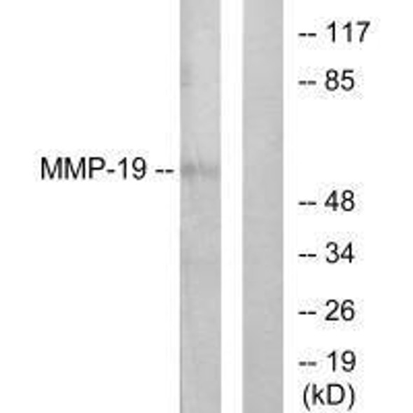 MMP19 Antibody (PACO23124)
