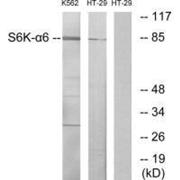 RPS6KA6 Antibody (PACO23292)