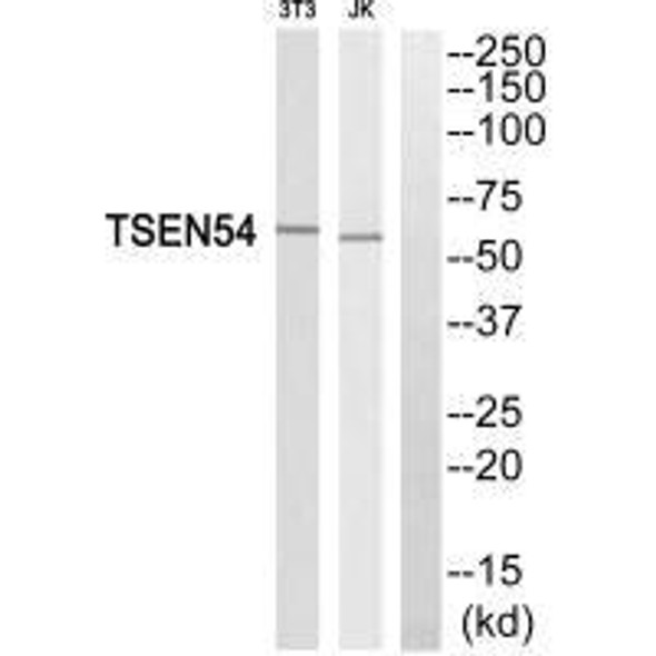TSEN54 Antibody (PACO23490)