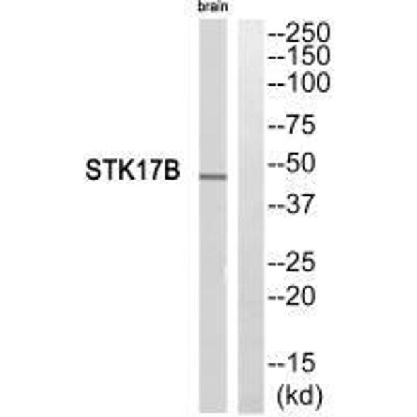 STK17B Antibody (PACO23508)