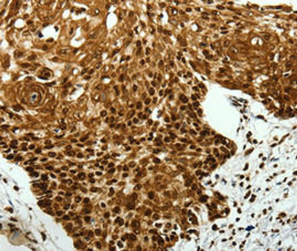 SCN11A Antibody (PACO23524)