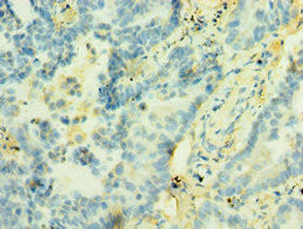 STX12 Antibody (PACO43761)