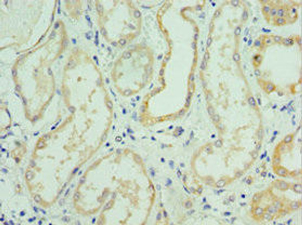 SLC39A6 Antibody (PACO43984)