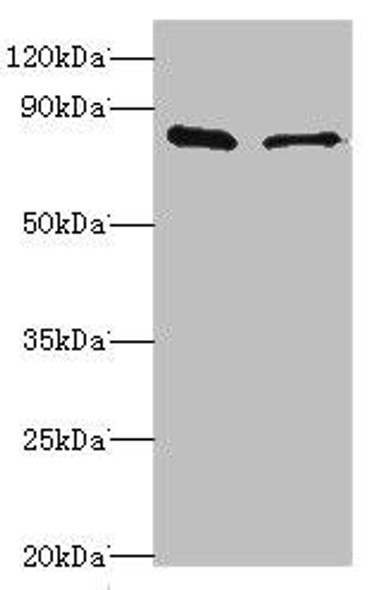 SLC39A6 Antibody (PACO43985)
