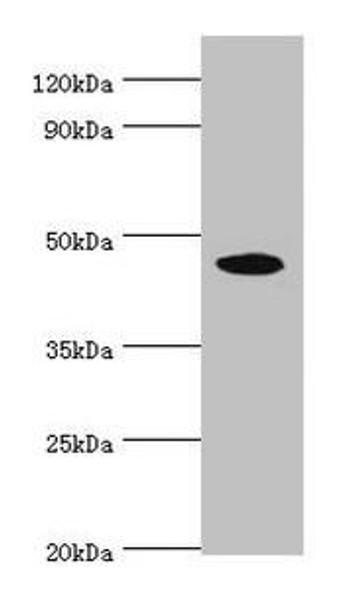 STK32A Antibody (PACO44101)