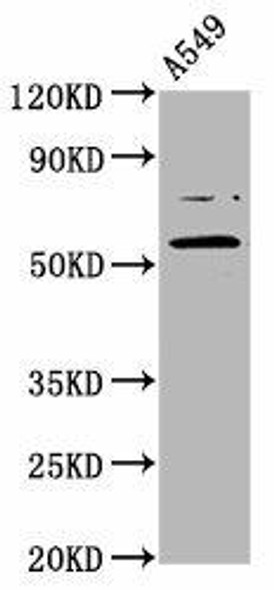 PRDM11 Antibody (PACO59457)